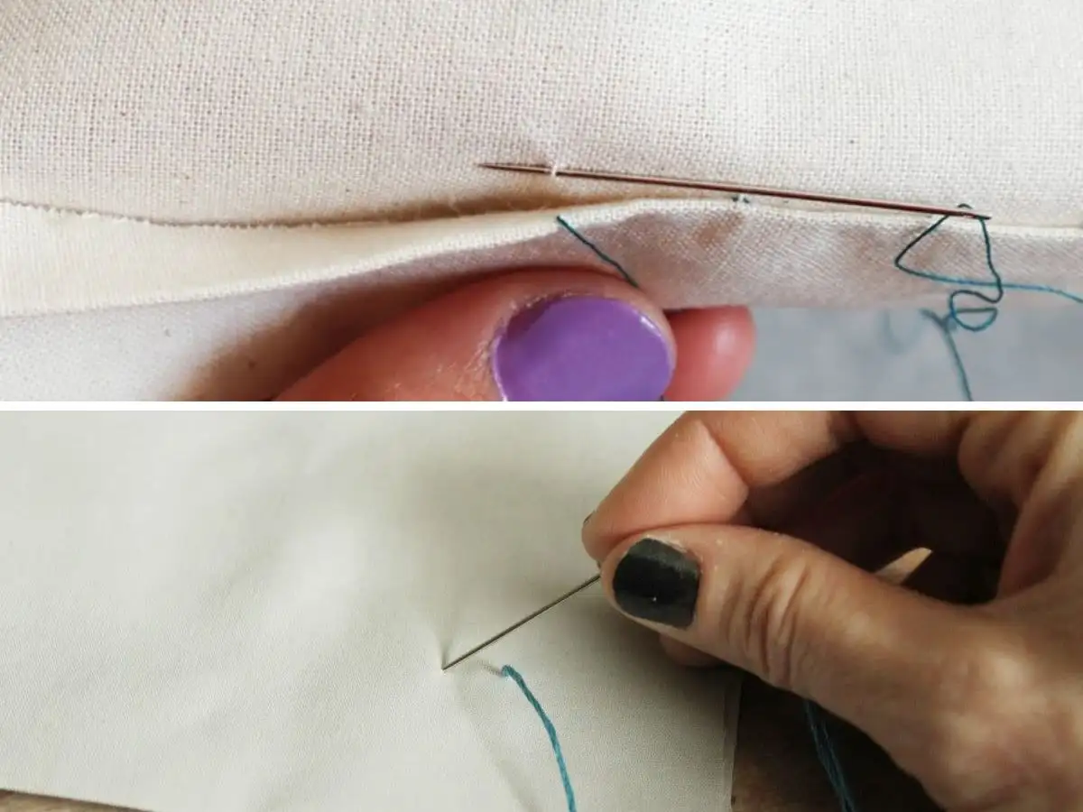 Khâu giấu chỉ cũng có thể vá lỗ thủng hiệu quả