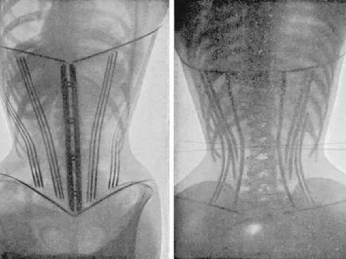 corset-la-gi-tim-hieu-ve-corset-cach-chon-va-su-dung-corset-an-toan-5376