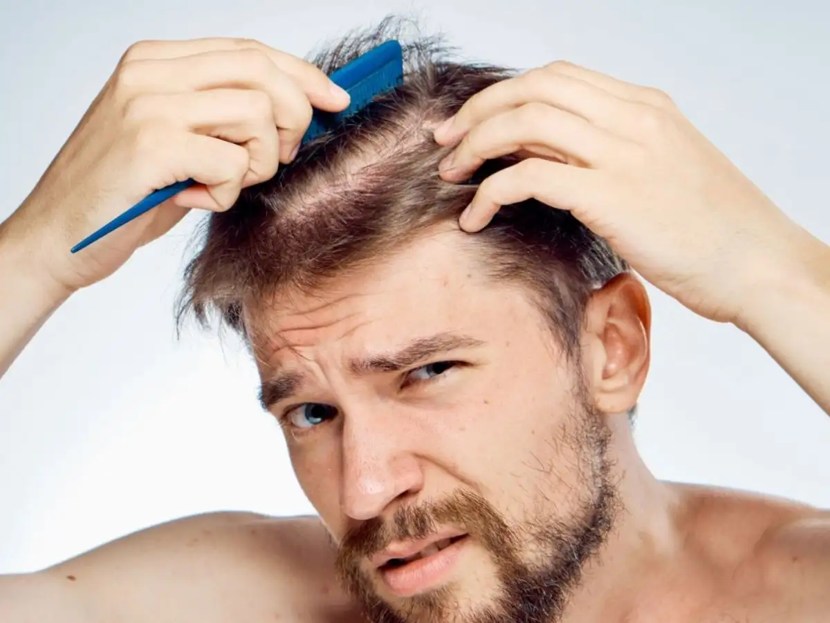 Hạn chế của gel vuốt tóc