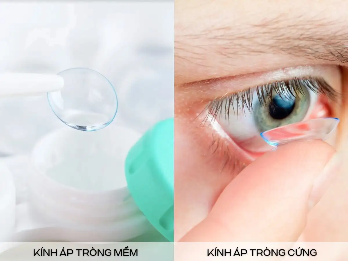 Kính áp tròng mềm và kính áp tròng cứng 