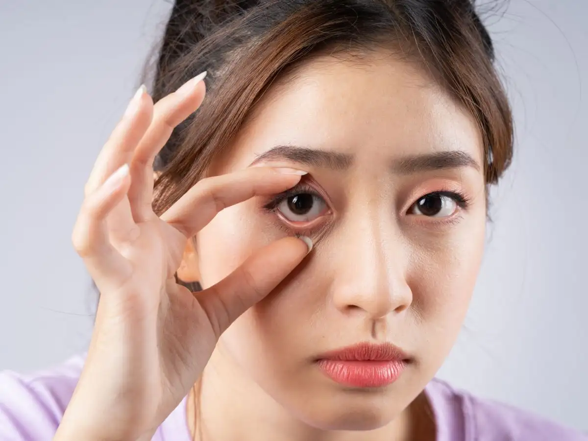 Những lưu ý quan trọng giúp bạn đeo kính áp tròng an toàn 