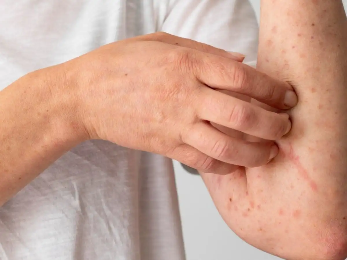 Các vấn đề về da liễu