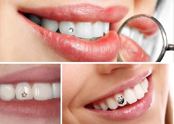 Có thực sự nên mua đá đính răng trên mạng không?