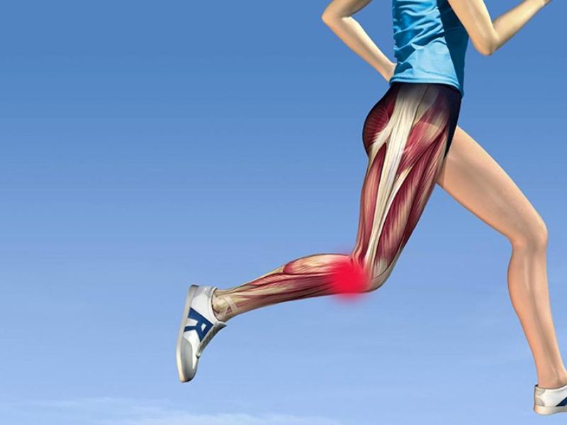Hội chứng dải chậu chày khi chạy bộ 