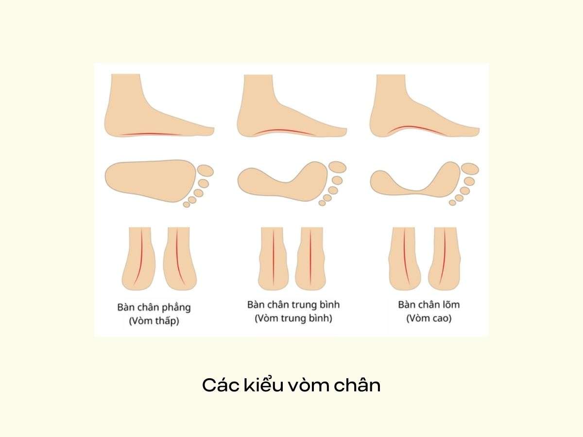 Các kiểu vòm chân