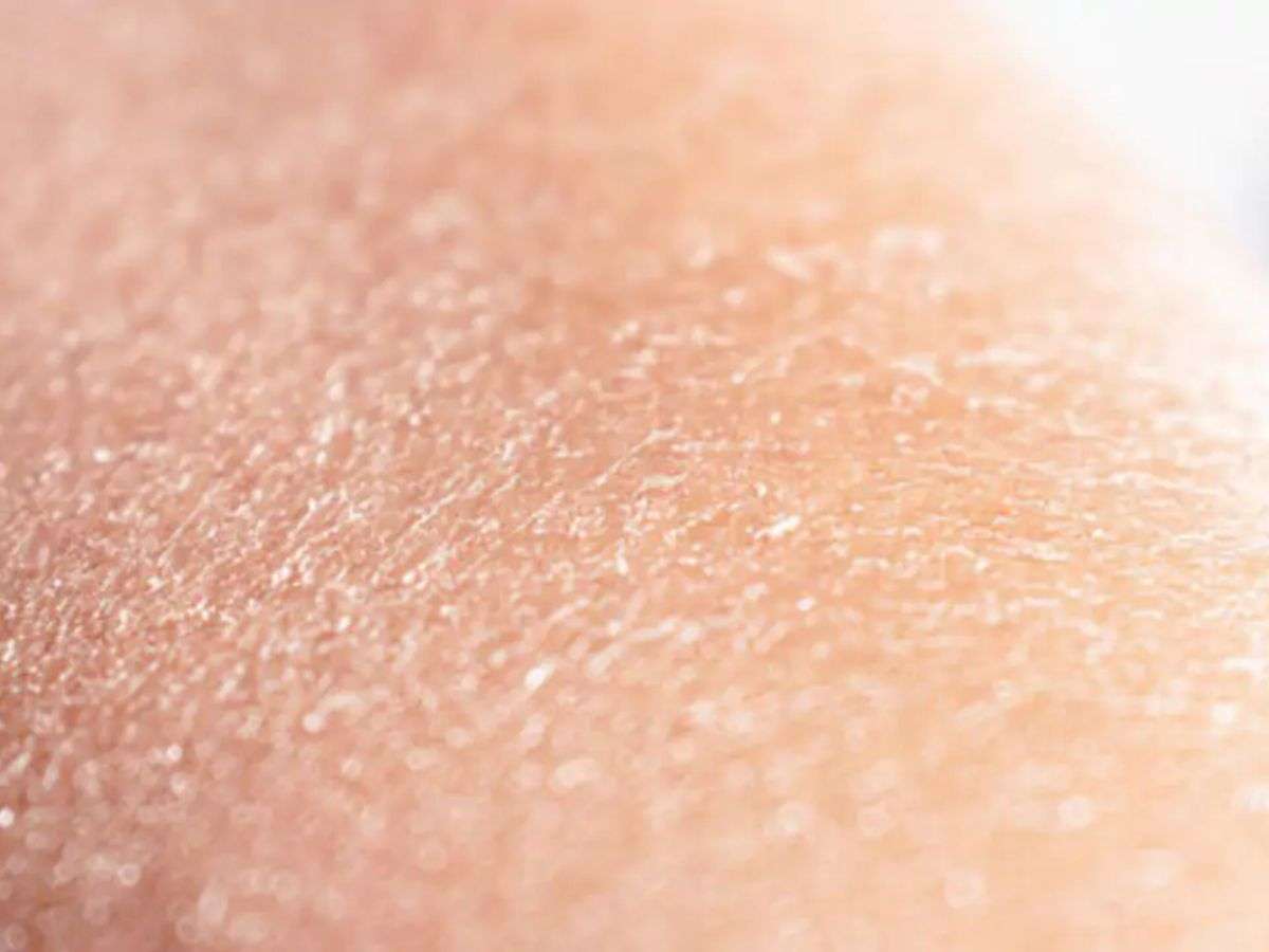 Bạn nên biết tình trạng da của bạn là gì