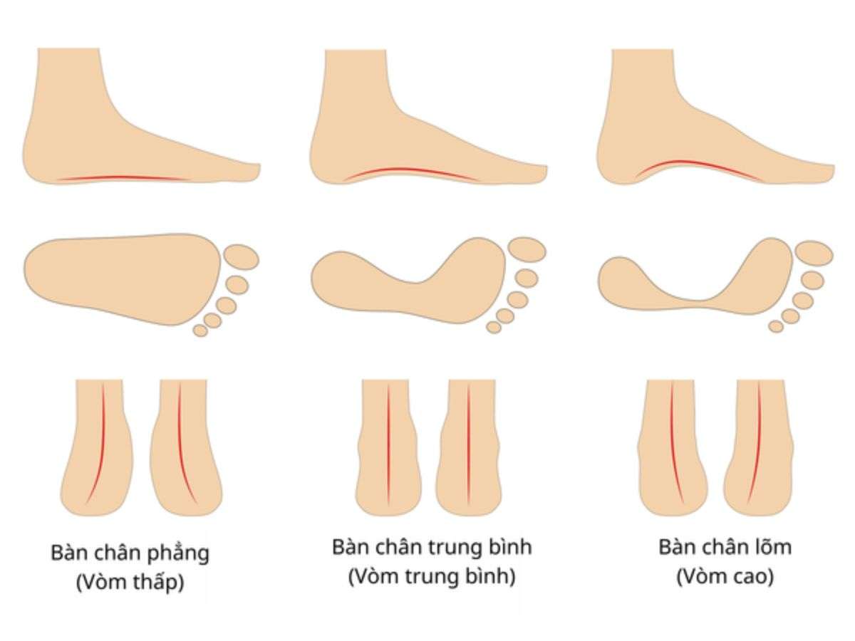 Chọn giày tennis theo form chân
