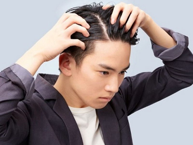 Tóc rụng có mọc lại được không Nguyên nhân và cách điều trị  Be Nature  Cosmetic