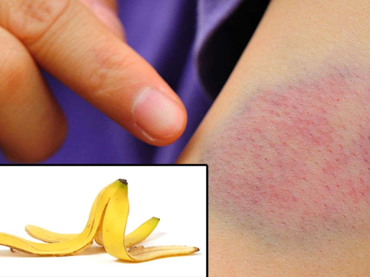 Vỏ chuối còn chứa một lượng lớn axit béo