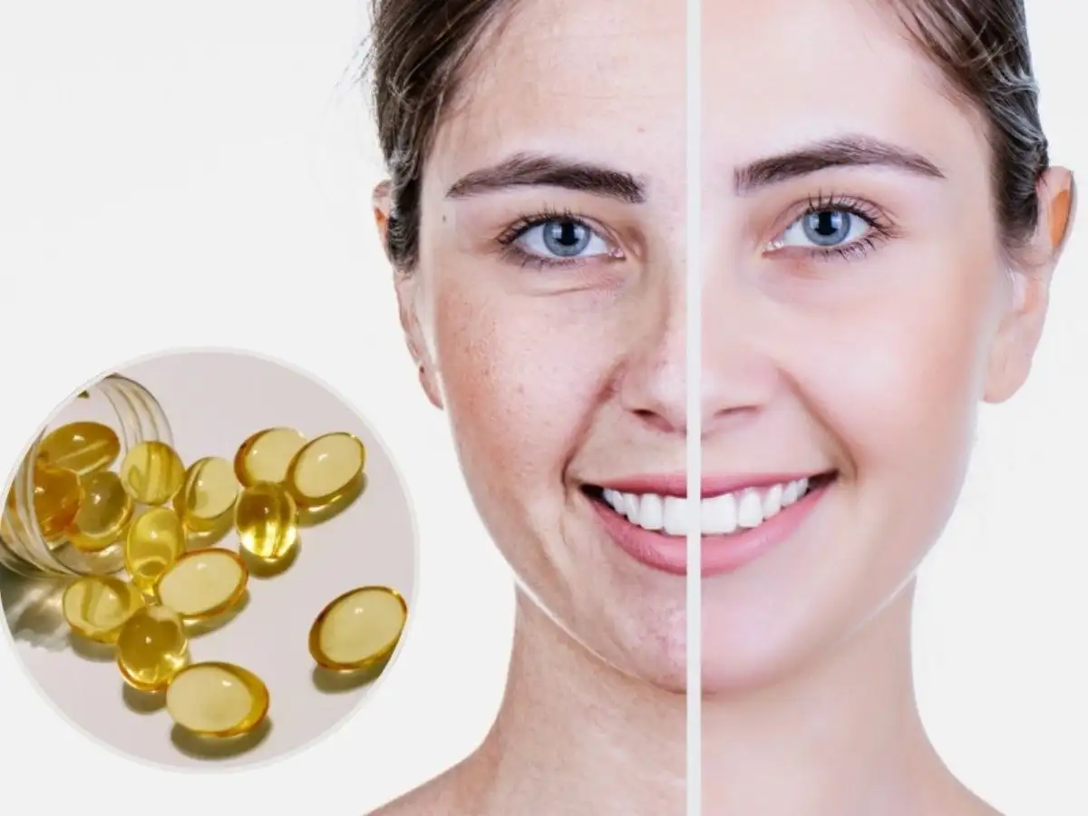 Vitamin E giúp duy trì sự đàn hồi và tươi trẻ cho làn da