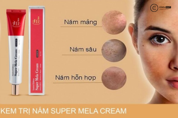 Anti Mela Cream Limited Edition – Mỹ phẩm trị nám Hàn Quốc hiệu quả