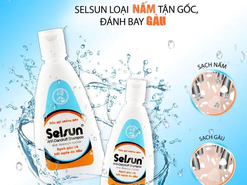 Dầu gội Selsun Anti-Dandruff Shampoo