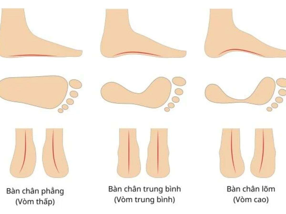 Mỗi người đều mang đặc điểm bàn chân khác nhau