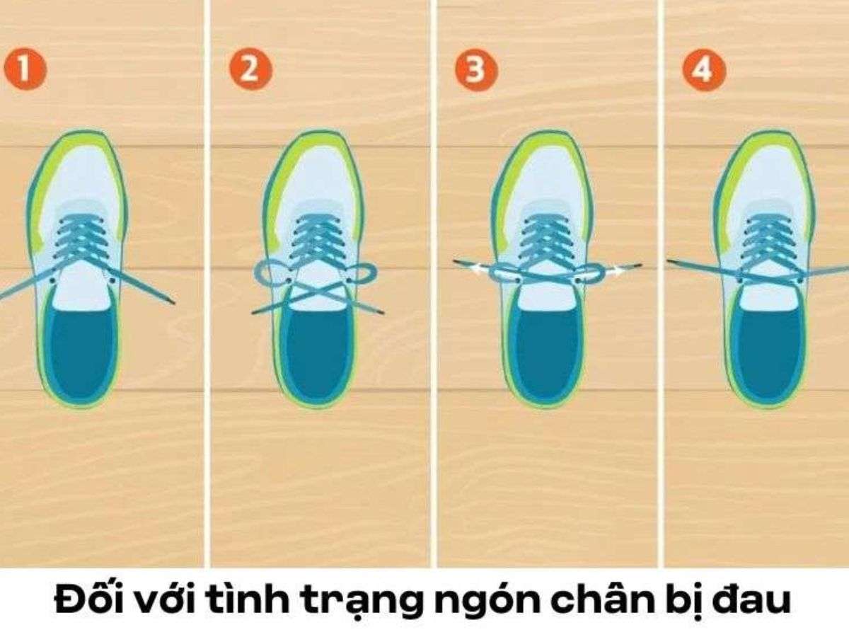 Buộc dây cho ngón chân đau 