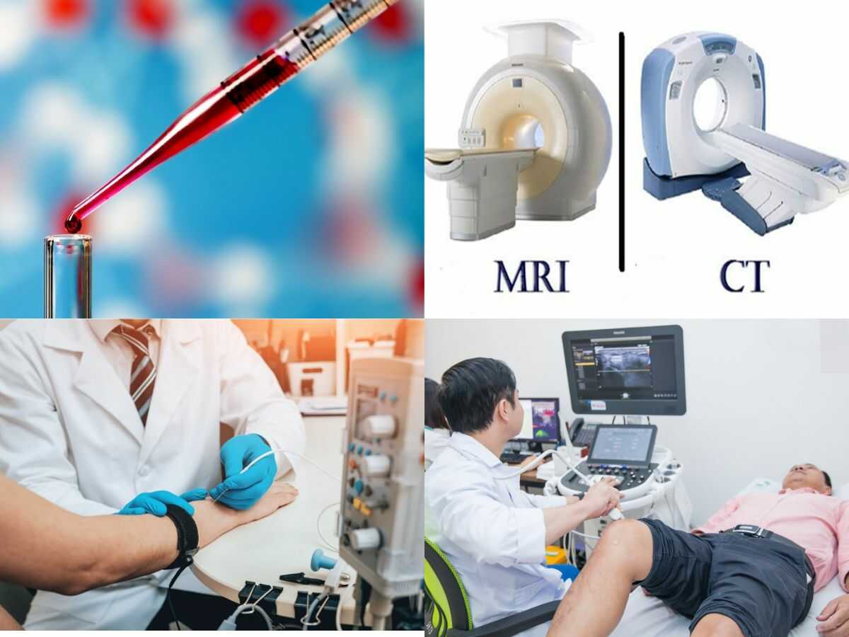 Các phương pháp chẩn đoán căng cơ như khám lâm sàng, xét nghiệm máu, MRI, điện cơ đồ và siêu âm