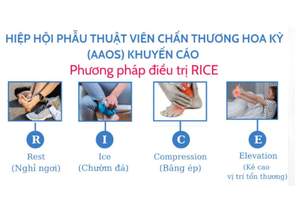 Căng cơ nhẹ có thể hồi phục nhờ nghỉ ngơi và chăm sóc ban đầu theo nguyên tắc RICE