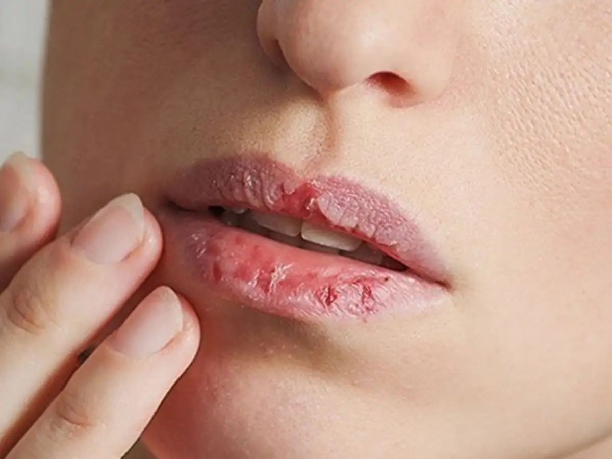 Những điều nên làm và không nên đụng vào khi tẩy tế bào chết môi