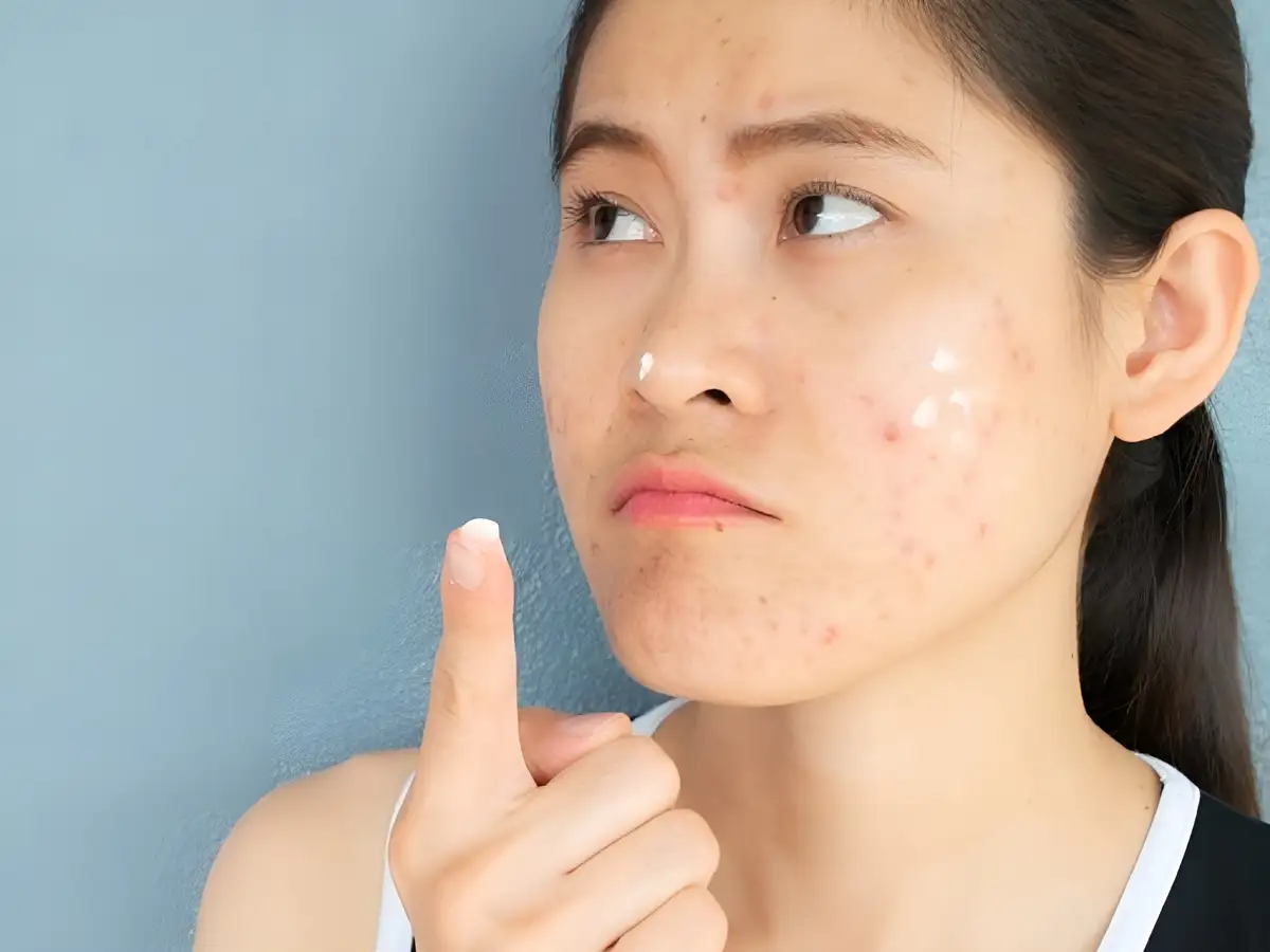 Dưỡng ẩm đúng cách là bước không thể thiếu để giữ da khỏe và cân bằng