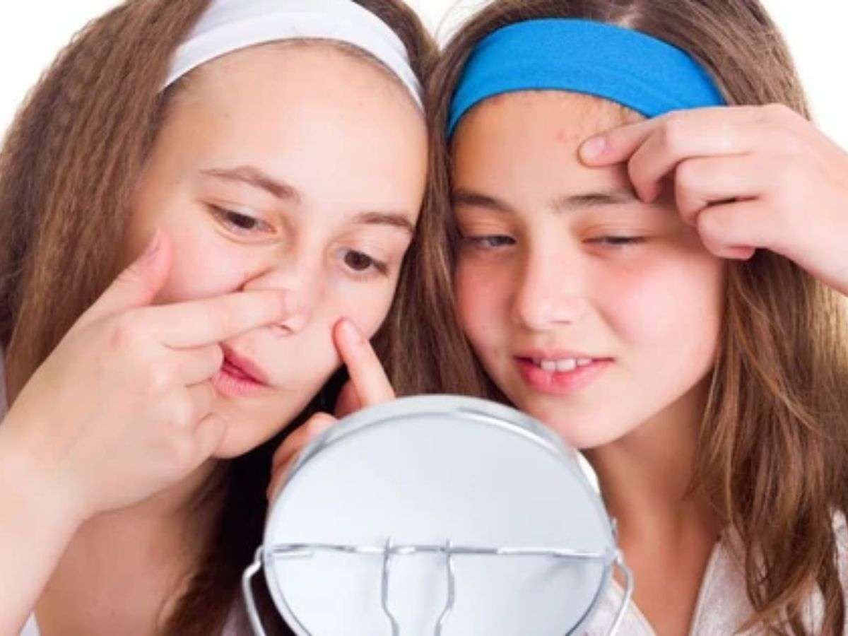 Thay đổi hormone khiến da bạn đổ dầu nhiều hơn vì sao?