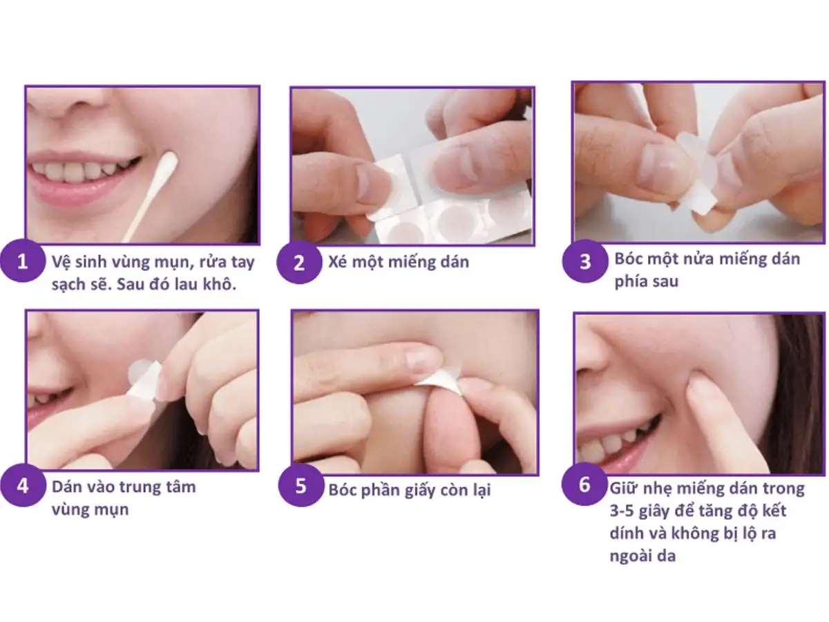 Cách dùng miếng dán mụn đúng chuẩn