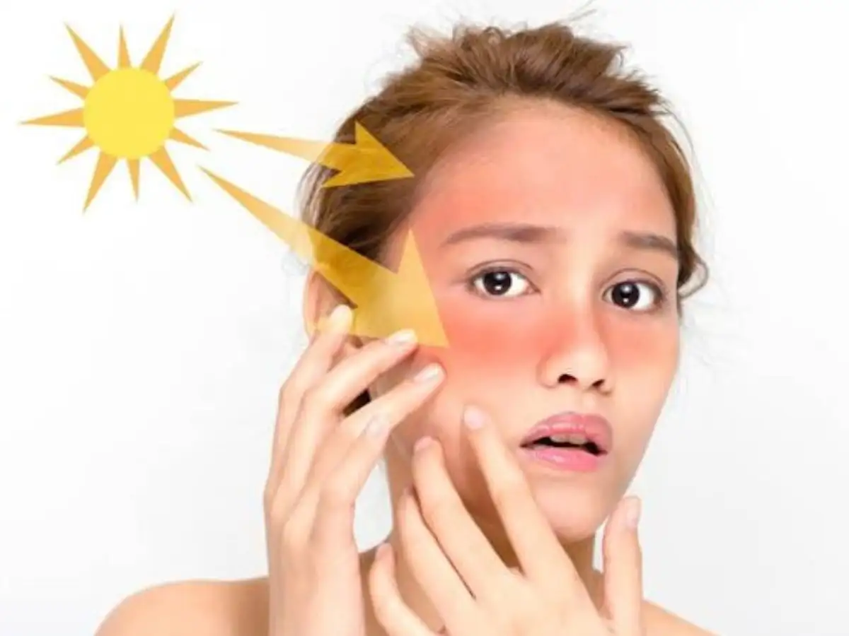 Tia UVA giống như kẻ trộm âm thầm, từ từ lẻn vào phá hoại cấu trúc da từ sâu bên trong