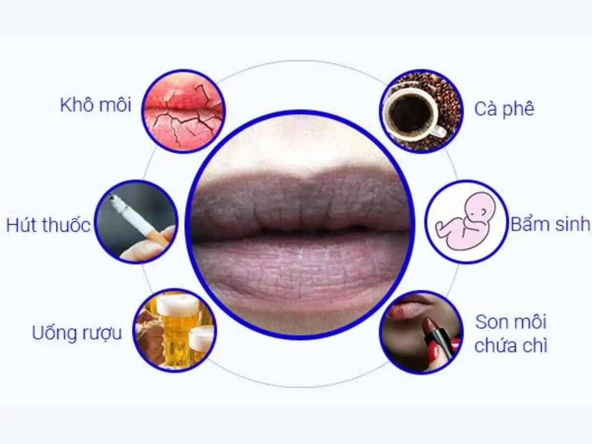 Nguyên nhân khiến đôi môi kém sắc