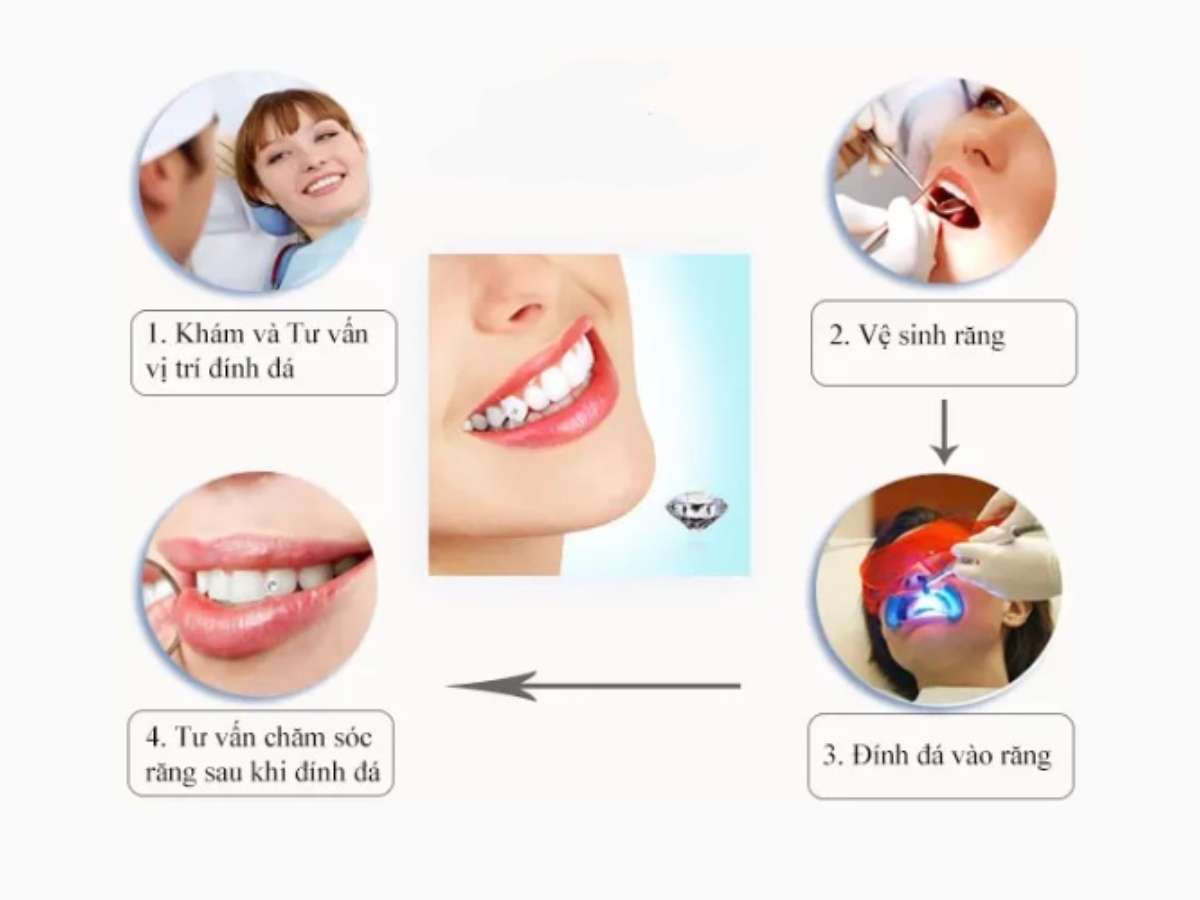 Quy trình tư vấn cần chuyên nghiệp và rõ ràng 