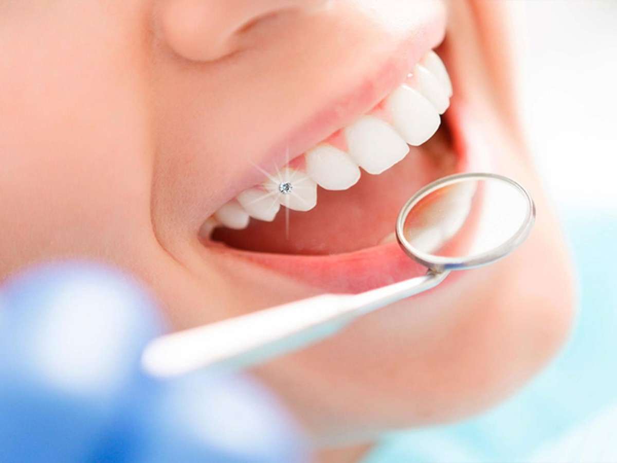 Nên chọn nha khoa có đội ngũ bác sĩ giàu kinh nghiệm, tận tâm