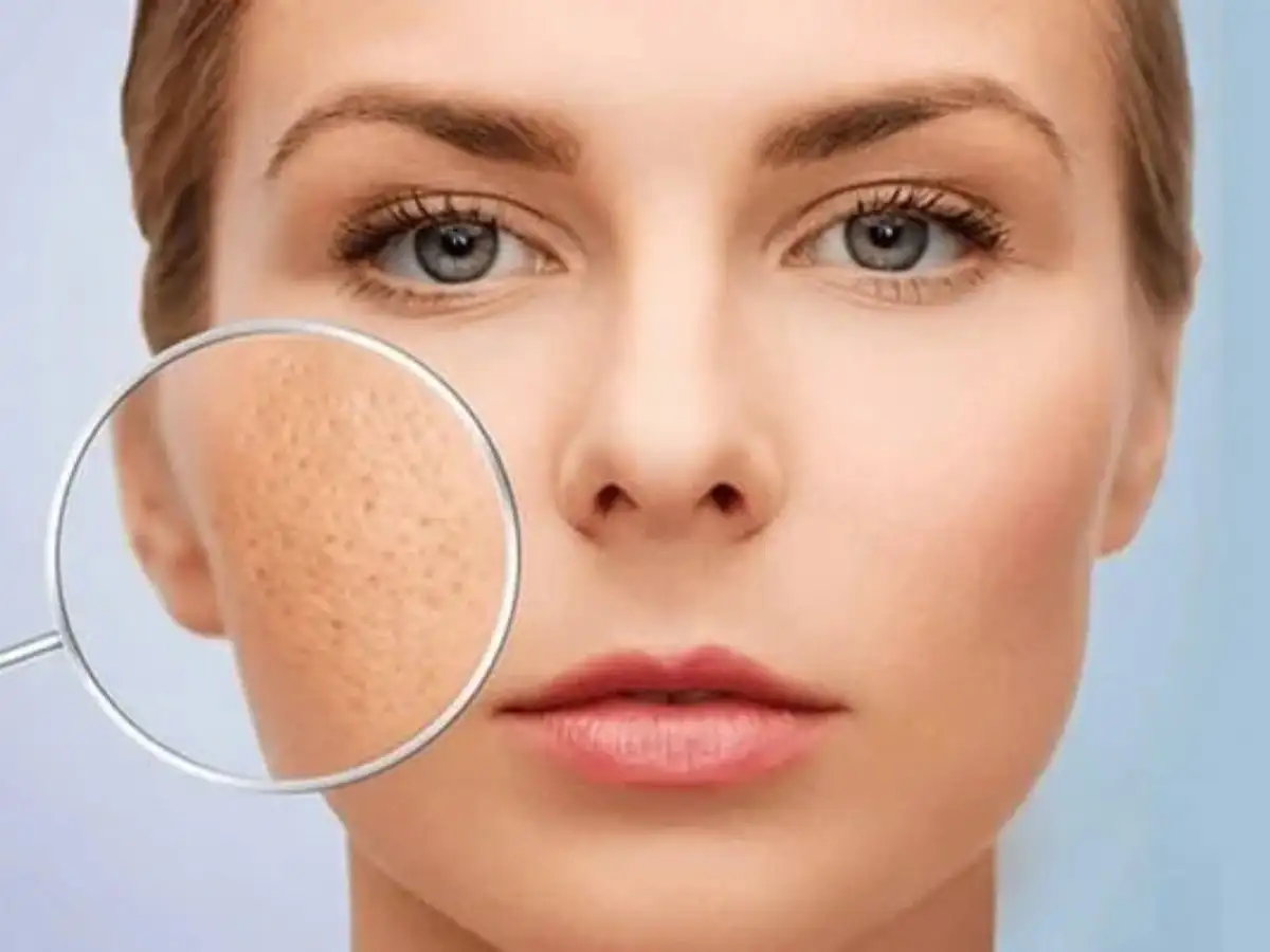 Làn da cải thiện lỗ chân lông khi dùng Niacinamide