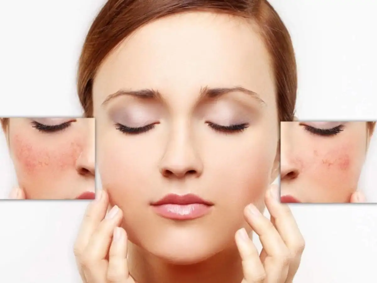Giảm nguy cơ kích ứng mỹ phẩm