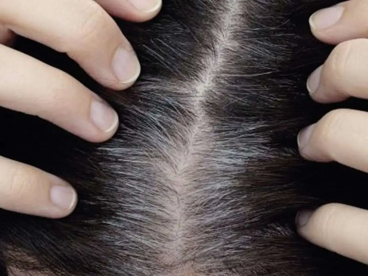 Các yếu tố cần cân nhắc khi đưa ra quyết định dùng thuốc nhuộm