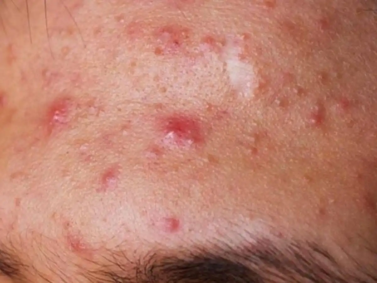 Lựa chọn kỹ để tránh kích ứng