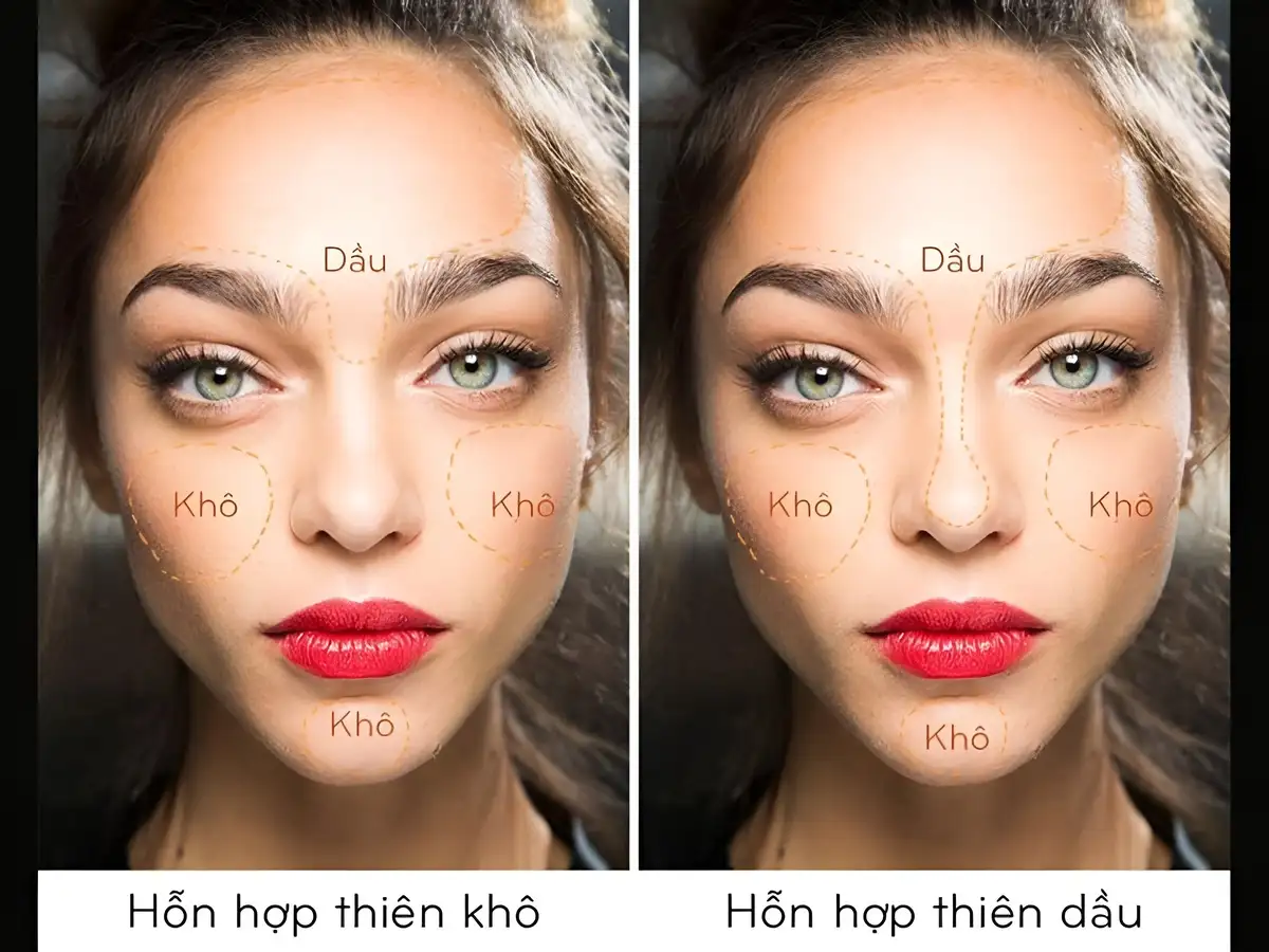 Phân biệt da hỗn hợp thiên khô và da hỗn hợp thiên dầu