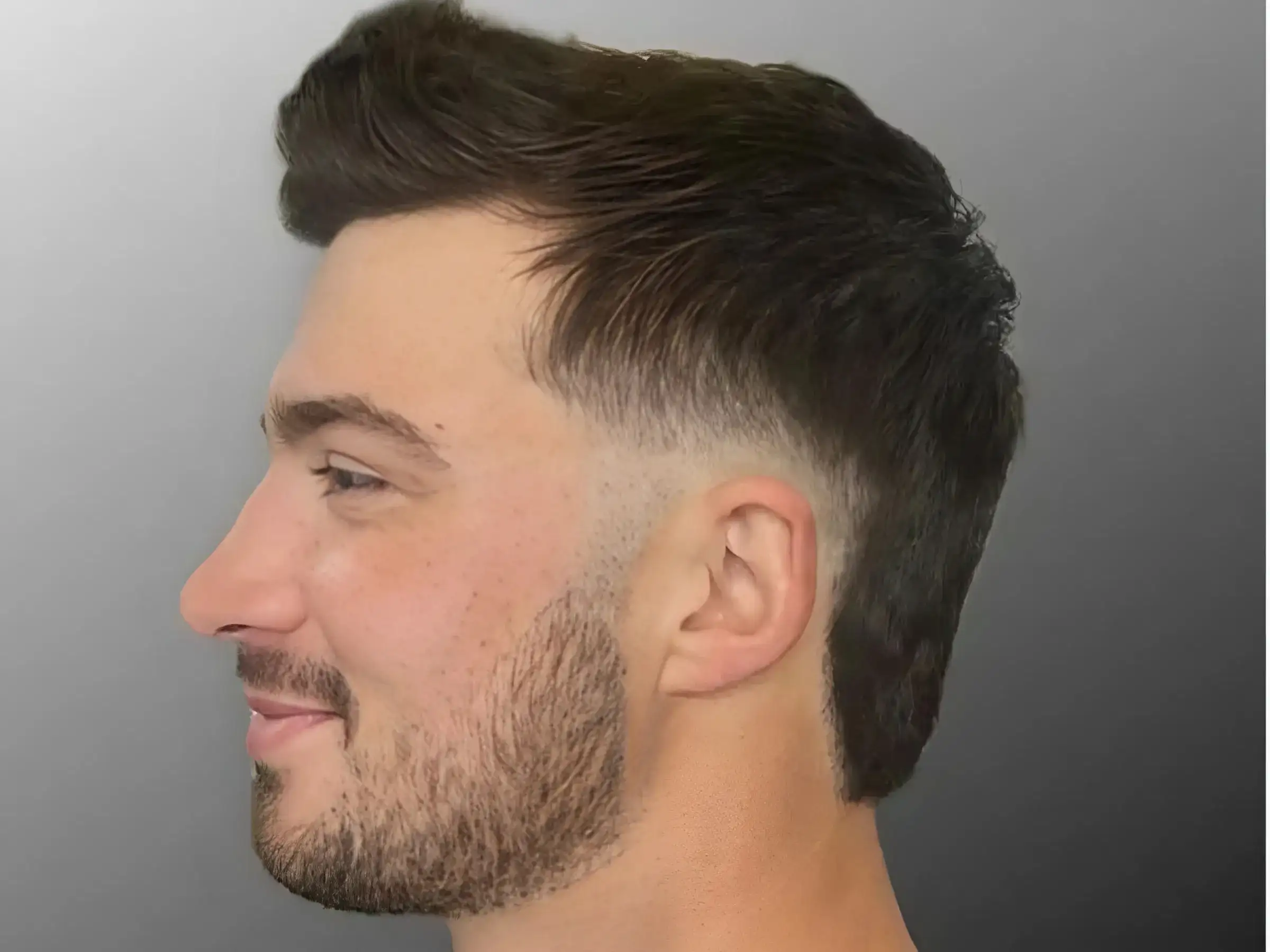 Kiểu tóc Mullet Fade/Undercut