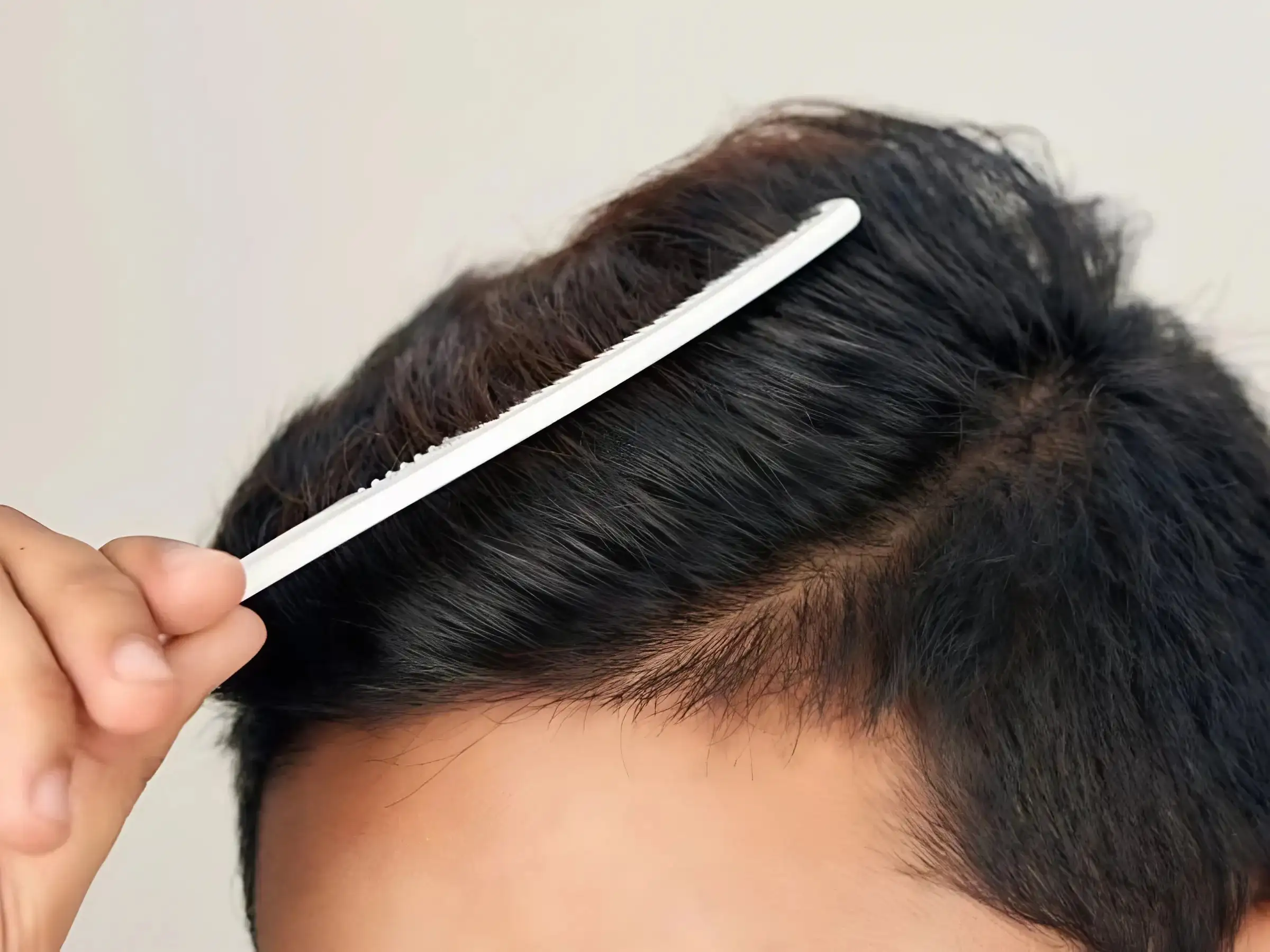 Những Lưu Ý Quan Trọng Khi Dùng Tinh Dầu Dưỡng Tóc