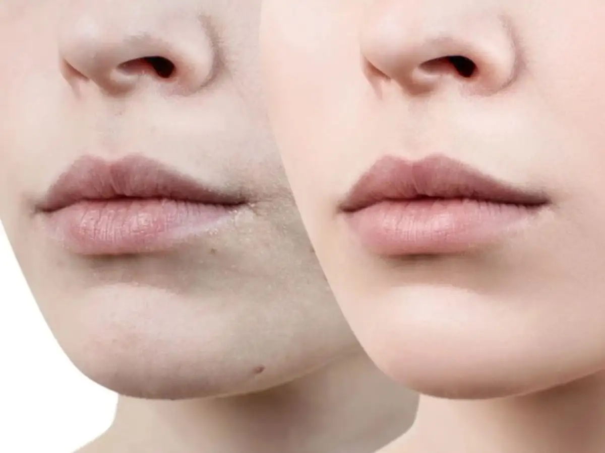 Trong một số trường hợp bạn cần đến sự tư vấn của bác sĩ da liễu