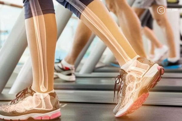 Lợi ích của chạy bộ: gia tăng mật độ xương, tránh loãng xương và hạn chế trật khớp