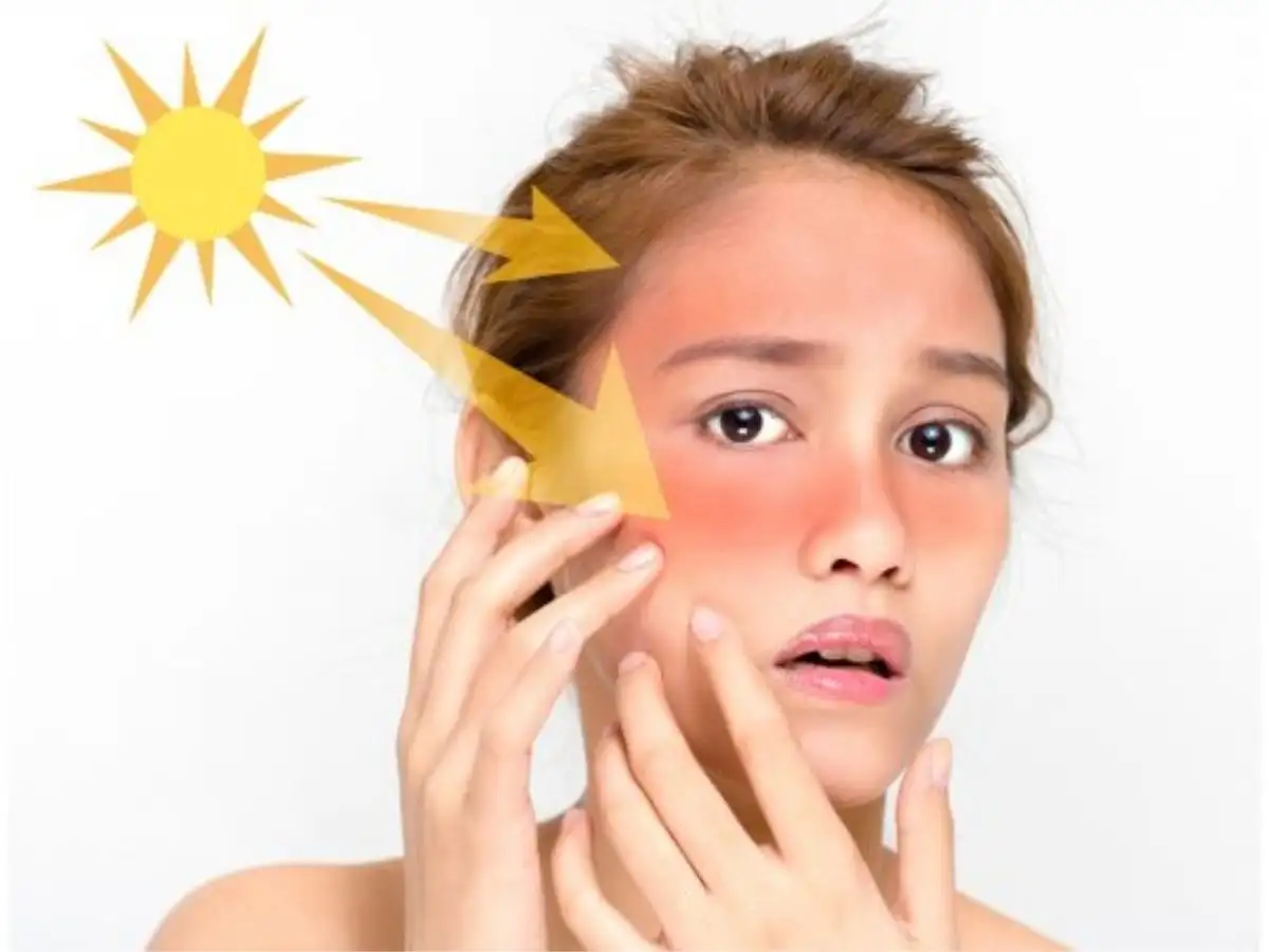Lỗi Bỏ Qua Kem Chống Nắng