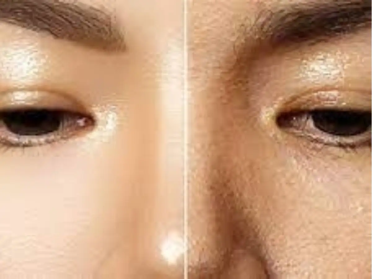Lỗi Đánh Nền Quá Dày