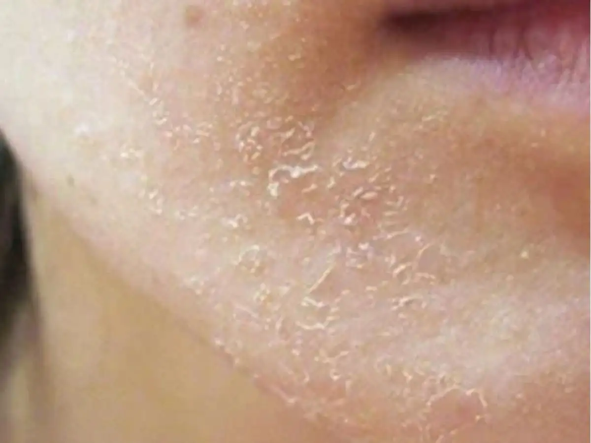  Lỗi Makeup Lớp Nền Bị Mốc