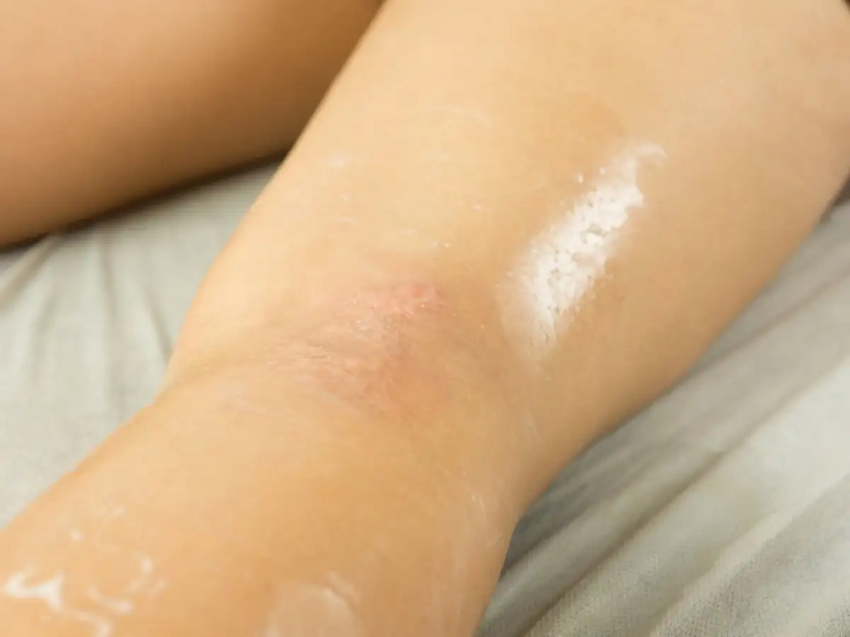 Việc chọn sai tông màu kem, tất phun hoặc miếng dán là lỗi thường gặp nhất