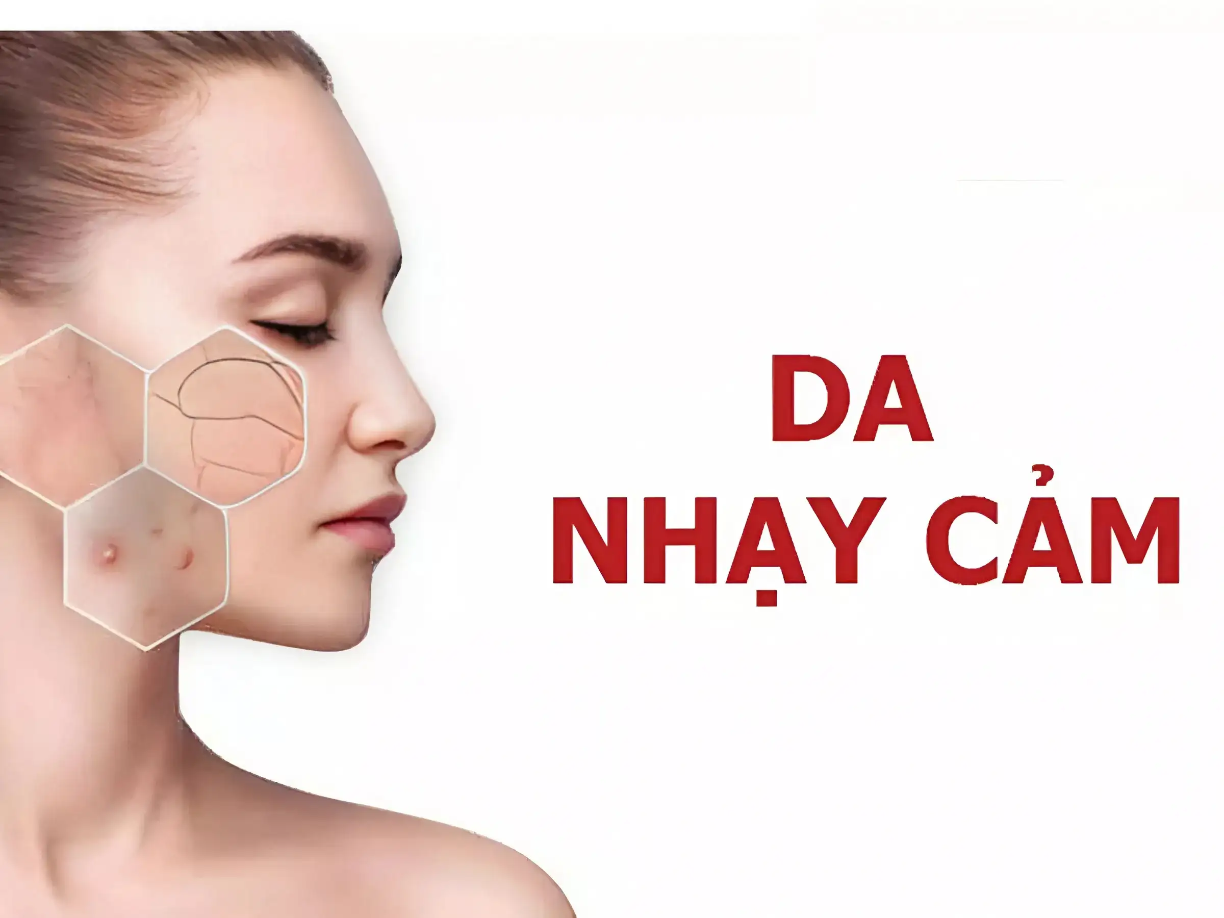 Team da nhạy cảm