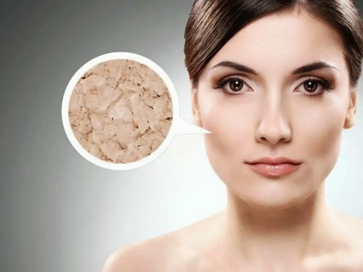 Thiếu bước skincare da có thể bị thiếu độ ẩm, khiến lớp trang điểm không đều