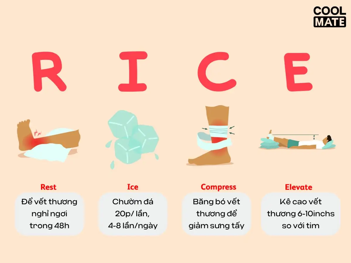 Áp dụng phương pháp R.I.C.E để xử lí các chấn thương nhẹ