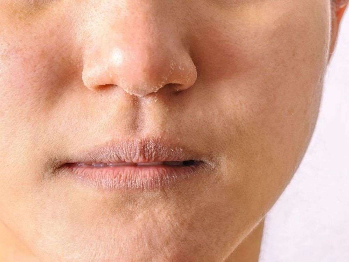 Da chưa được cấp ẩm đầy đủ thì đánh nền kiểu gì cũng dễ mốc