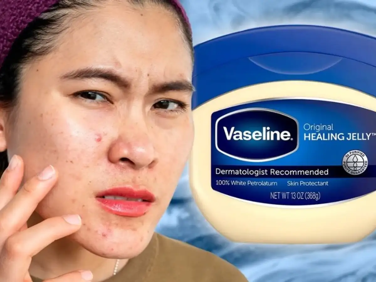 Nhược điểm khi thực hiện tẩy trang bằng Vaseline 