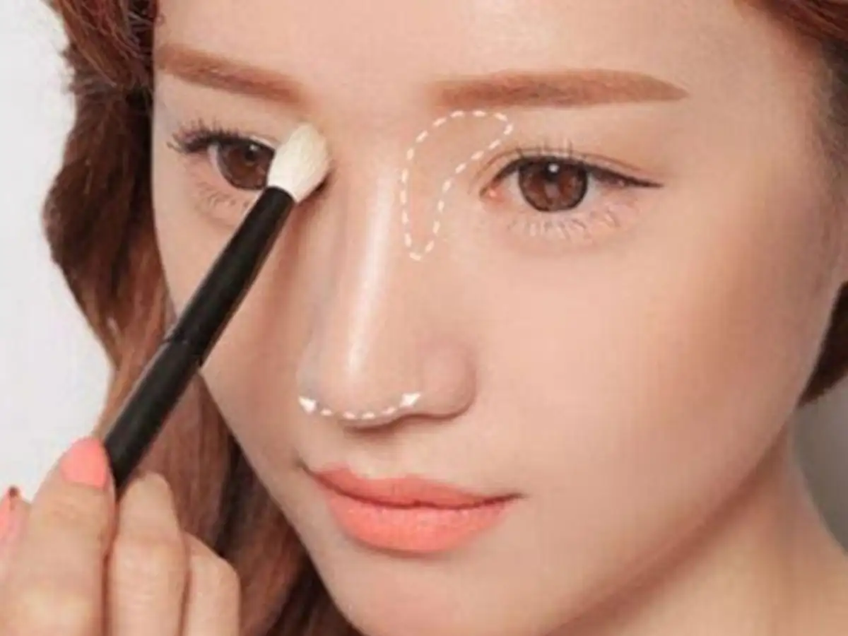 Tạo hốc mắt cho mắt 1 mí