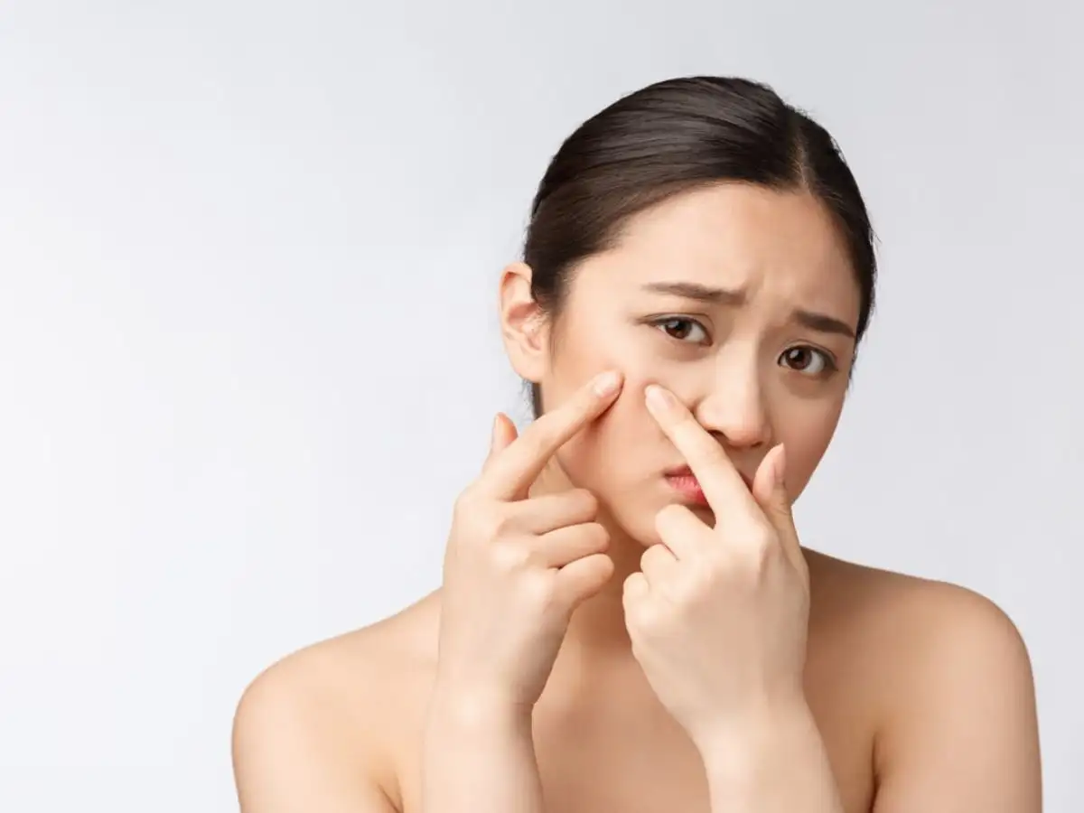 Duy trì các thói quen tốt để ngăn mụn ẩn quay trở lại