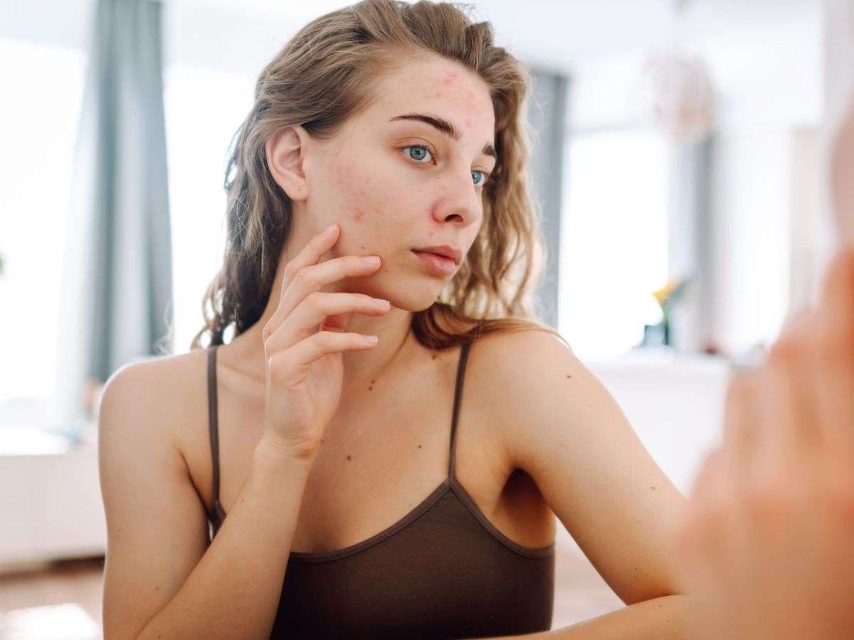 Các nguyên nhân gây nên mụn ẩn