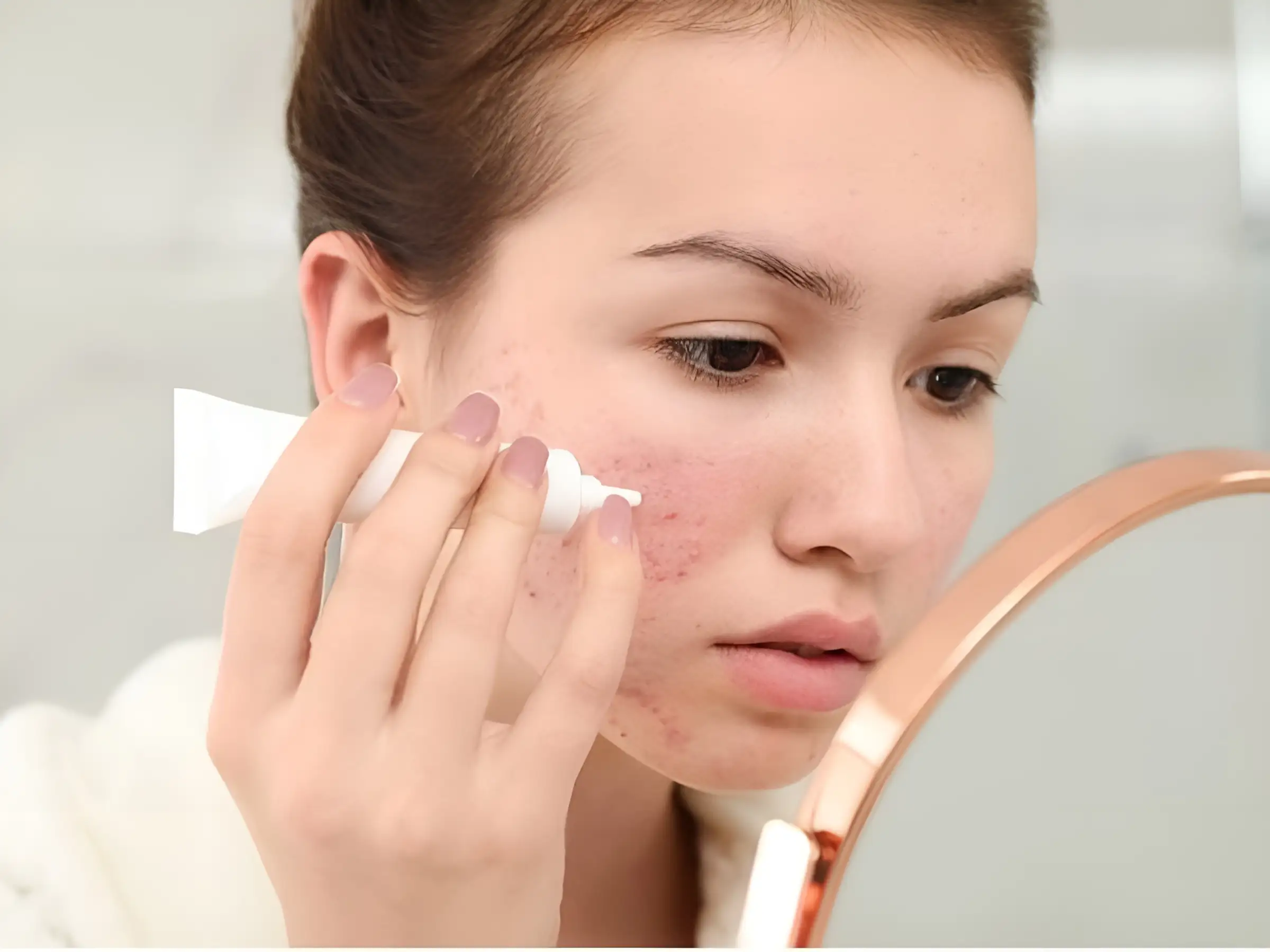 Nên thoa treatment lên vùng da cần điều trị